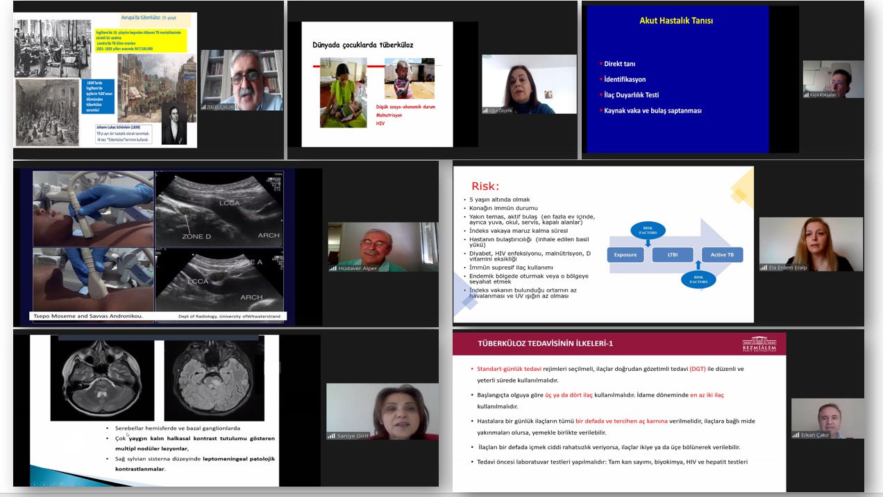 Türk Toraks Derneği Çocuk Göğüs Hastalıkları Çalışma Grubu ile İstanbul Medeniyet Üniversitesi Ortak Webinarı 