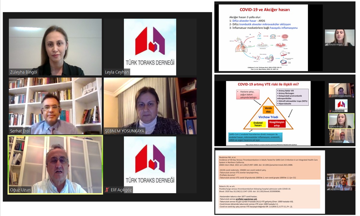 Türk Toraks Derneği İç Anadolu Şube ve Klinik Sorunlar Çalışma Grubu Ortak Ekim Ayı Webinarı 