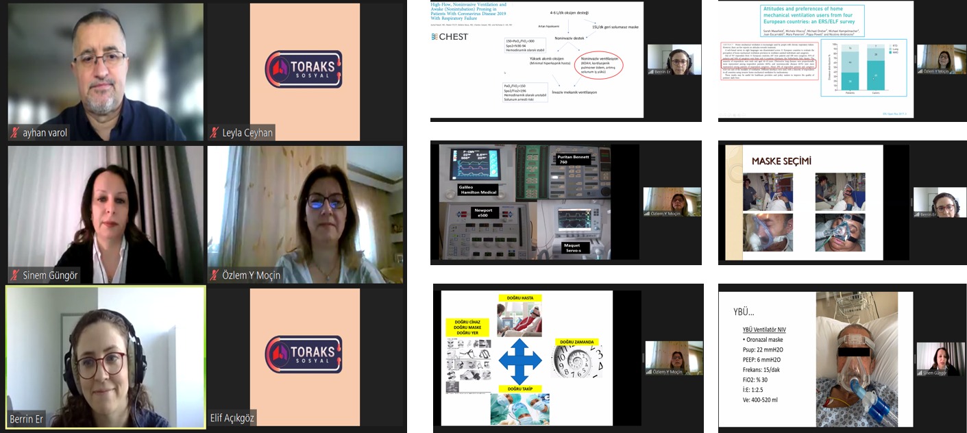 Türk Toraks Derneği Akdeniz Şubesi ile Solunum Yetmezliği ve Yoğun Bakım Çalışma Grubu Ortak 