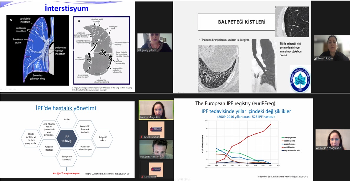 Türk Toraks Derneği Batı Anadolu Şubesi ve Klinik Sorunlar Çalışma Grubu Ortak Nisan Ayı Webinarı 