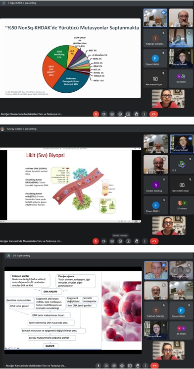 Türk Toraks Derneği Temel ve Translasyonel Araştırmalar Çalışma Grubu Mayıs Ayı Bilimsel Toplantısı 