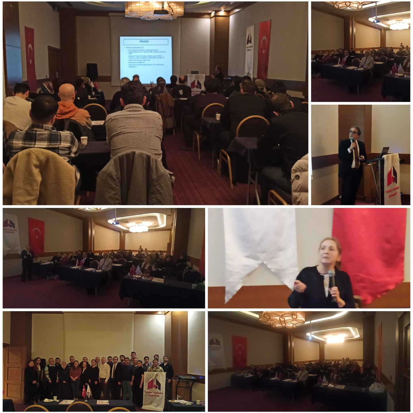 Türk Toraks Derneği İç Anadolu Şubesi, Çocuk Göğüs Hastalıkları Çalışma Grubu ve Göğüs Cerrahisi Çalışma Grubu Ortak Ocak Ayı Bilimsel Toplantısı 